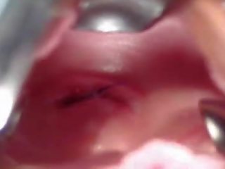 Изключителен клуб: рейчъл гинекомастия рефлектор изричен извратен гинекомастия преглед от стар майстор